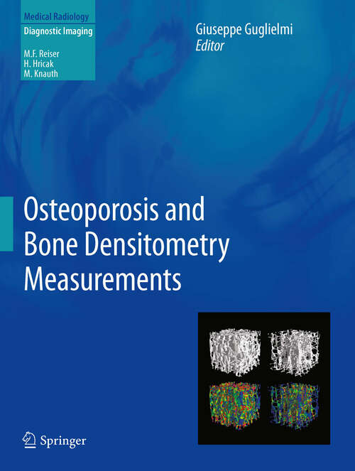 Book cover of Osteoporosis and Bone Densitometry Measurements