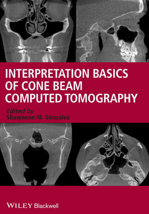 Book cover of Interpretation Basics of Cone Beam Computed Tomography