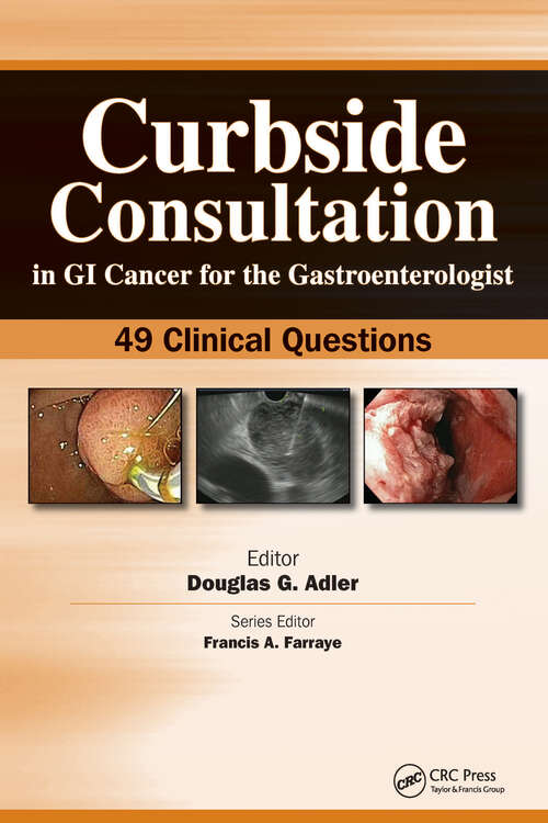 Book cover of Curbside Consultation in GI Cancer for the Gastroenterologist: 49 Clinical Questions (Curbside Consultation in Gastroenterology)