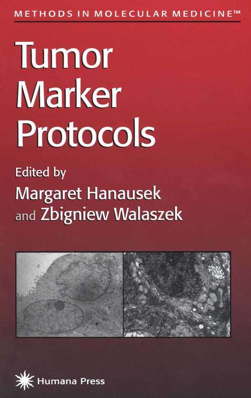 Book cover of Tumor Marker Protocols