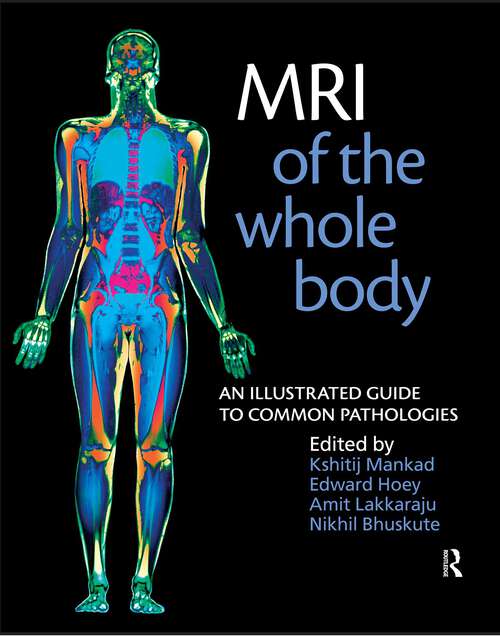 Book cover of MRI of the Whole Body: An Illustrated Guide for Common Pathologies