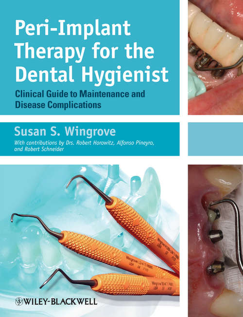 Book cover of Peri-Implant Therapy for the Dental Hygienist