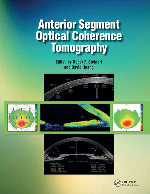 Book cover of Anterior Segment Optical Coherence Tomography