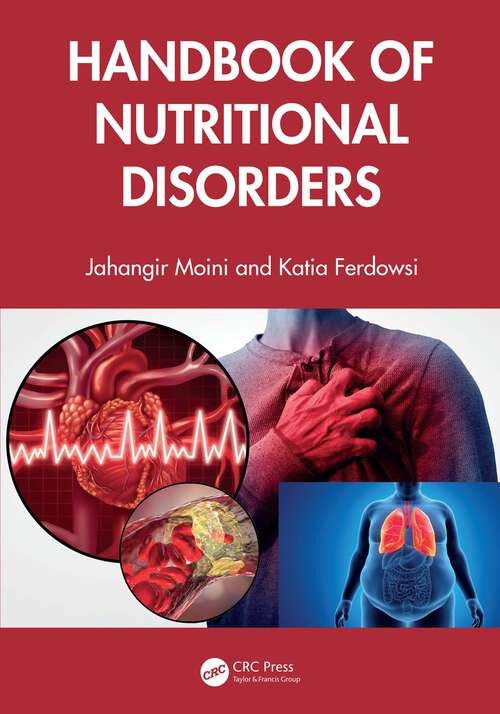 Book cover of Handbook of Nutritional Disorders