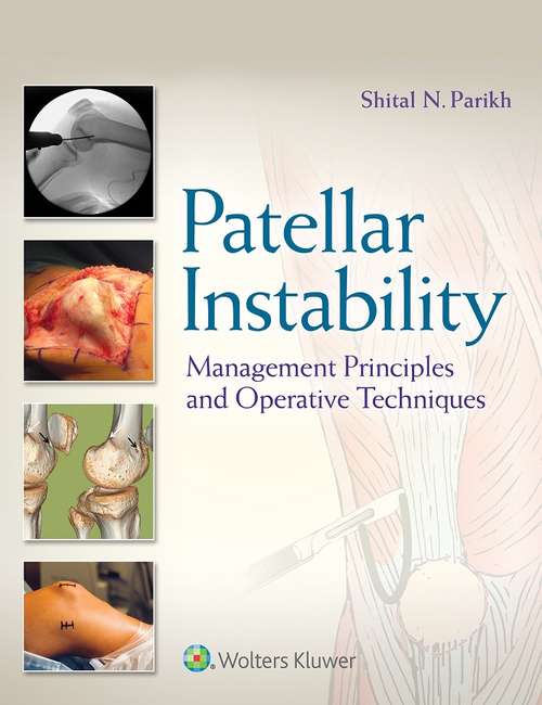 Book cover of Patellar Instability: Management Principles and Operative Techniques