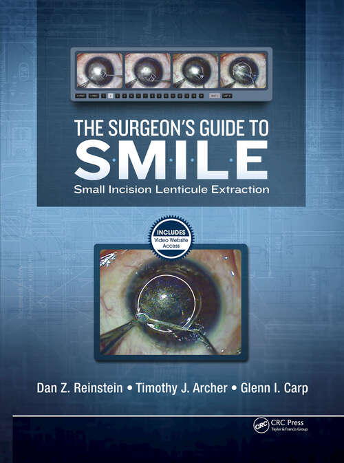 Book cover of The Surgeon’s Guide to SMILE: Small Incision Lenticule Extraction