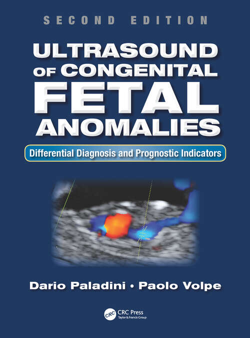 Book cover of Ultrasound of Congenital Fetal Anomalies: Differential Diagnosis and Prognostic Indicators, Second Edition (2)