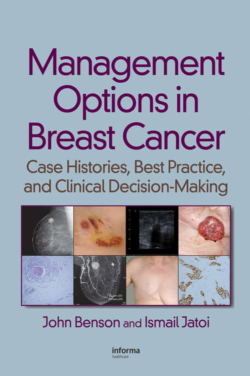 Book cover of Management Options in Breast Cancer: Case Histories, Best Practice, and Clinical Decision-Making