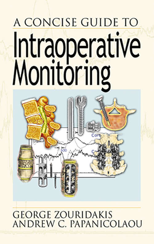 Book cover of A Concise Guide to Intraoperative Monitoring