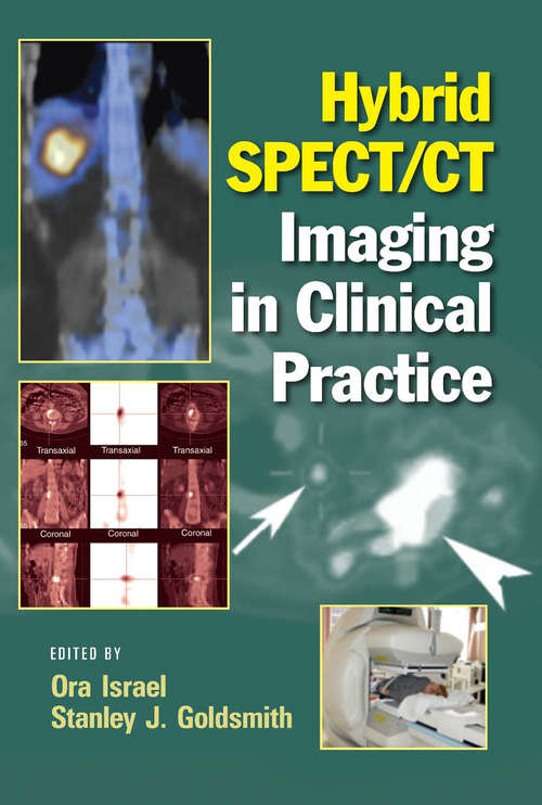 Book cover of Hybrid SPECT/CT Imaging in Clinical Practice