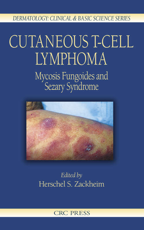 Book cover of Cutaneous T-Cell Lymphoma: Mycosis Fungoides and Sezary Syndrome