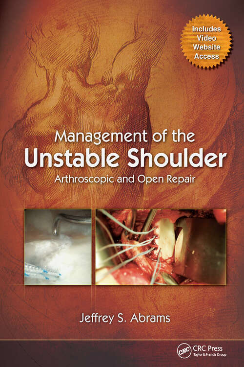 Book cover of Management of the Unstable Shoulder: Arthroscopic and Open Repair