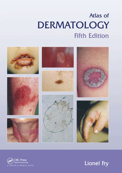 Book cover of Atlas of Dermatology, Fifth Edition (Encyclopedia of Visual Medicine Series)