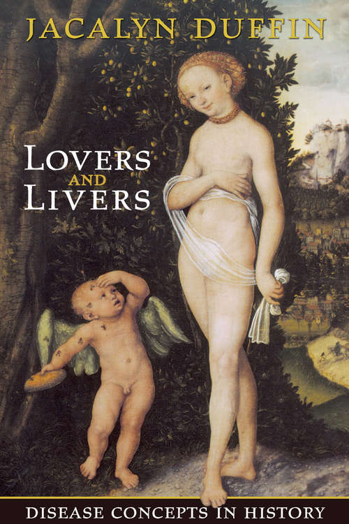 Book cover of Lovers and Livers