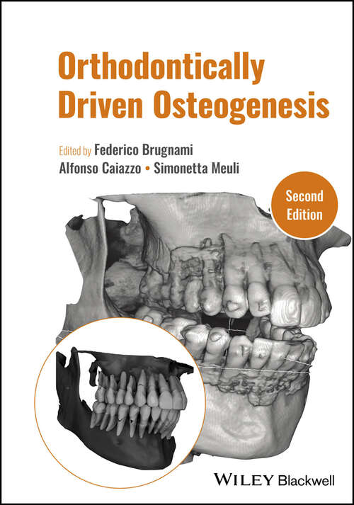 Book cover of Orthodontically Driven Osteogenesis (2)