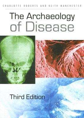 Book cover of The Archaeology of Disease (Third Edition)