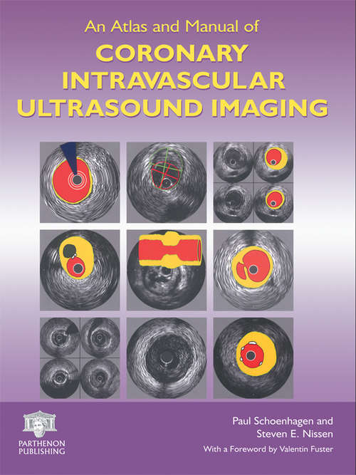 Book cover of An Atlas and Manual of Coronary Intravascular Ultrasound Imaging