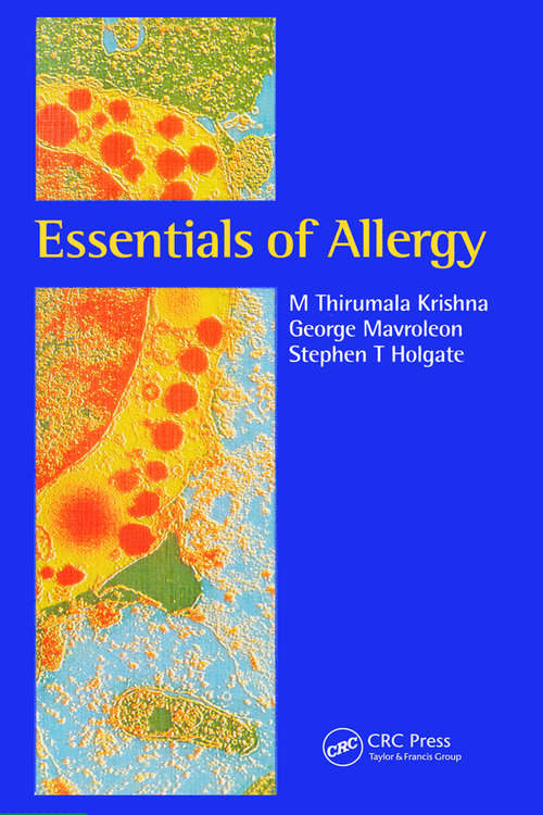 Book cover of Essentials of Allergy