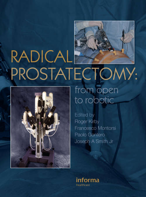 Book cover of Radical Prostatectomy: From Open to Robotic