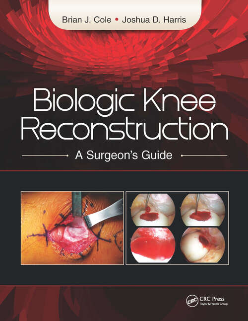 Book cover of Biologic Knee Reconstruction: A Surgeon's Guide