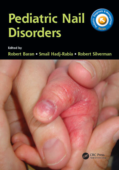 Book cover of Pediatric Nail Disorders (Pediatric Diagnosis and Management)