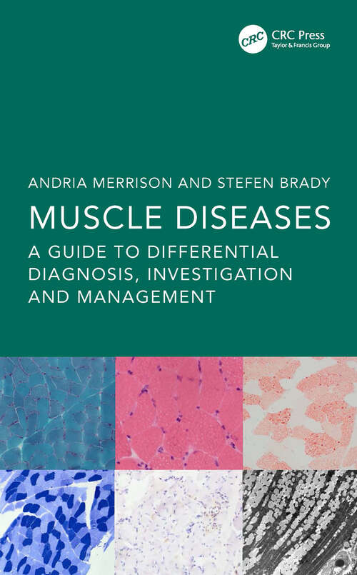 Book cover of Muscle Diseases: A Guide to Differential Diagnosis, Investigation and Management (1)