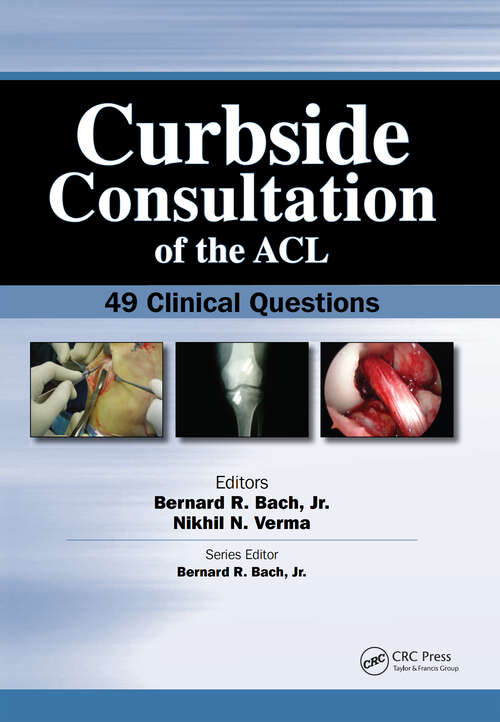 Book cover of Curbside Consultation of the ACL: 49 Clinical Questions (Curbside Consultation in Orthopedics)