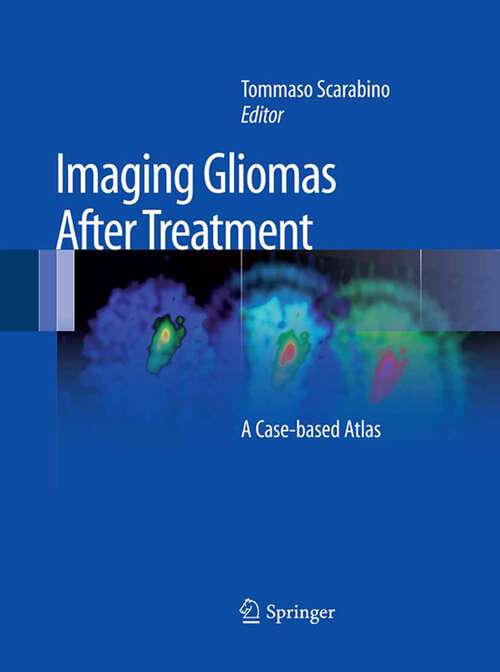 Book cover of Imaging Gliomas After Treatment