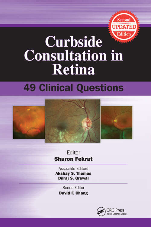 Book cover of Curbside Consultation in Retina: 49 Clinical Questions (Curbside Consultation in Ophthalmology)