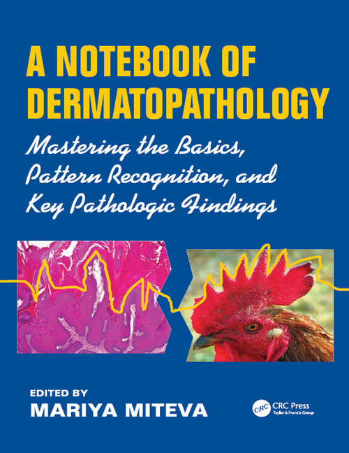 Book cover of A Notebook of  Dermatopathology: Mastering the Basics, Pattern Recognition, and Key Pathologic Findings