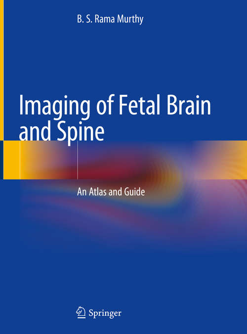 Book cover of Imaging of Fetal Brain and Spine: An Atlas and Guide (1st ed. 2019)