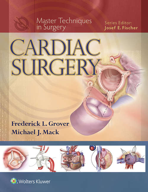 Book cover of Master Techniques in Surgery: Cardiac Surgery (Master Techniques in Surgery)