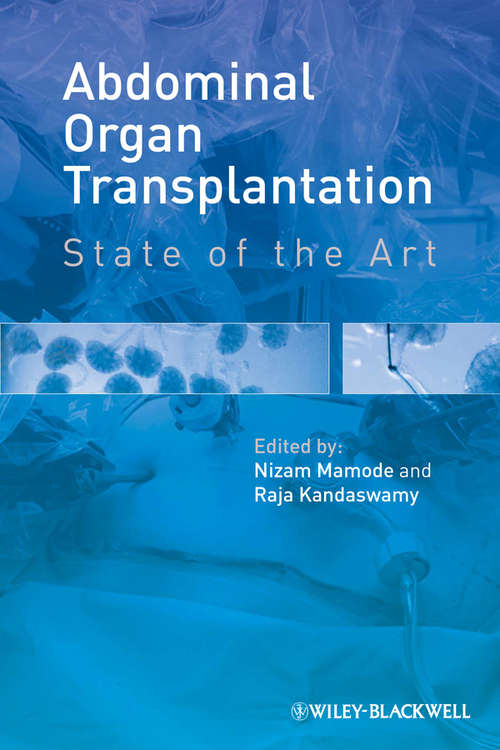 Book cover of Abdominal Organ Transplantation