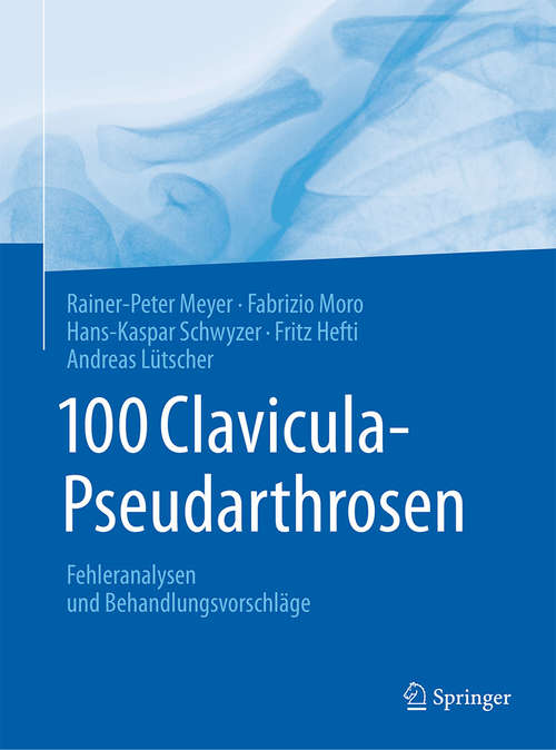 Book cover of 100 Clavicula-Pseudarthrosen: Fehleranalysen und Behandlungsvorschläge