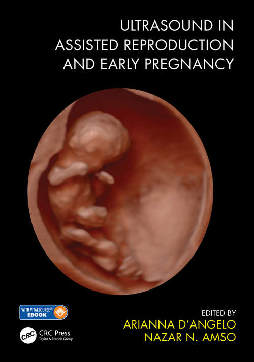 Book cover of Ultrasound in Assisted Reproduction and Early Pregnancy