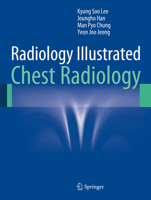 Book cover of Radiology Illustrated: Chest Radiology