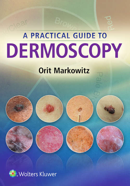 Book cover of A Practical Guide to Dermoscopy