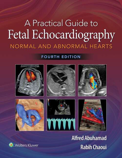 Book cover of A Practical Guide to Fetal Echocardiography: Normal and Abnormal Hearts