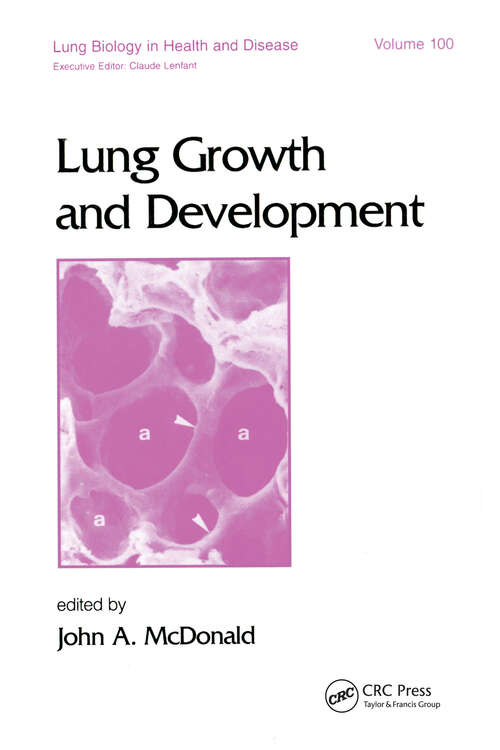 Book cover of Lung Growth and Development (Lung Biology in Health and Disease)