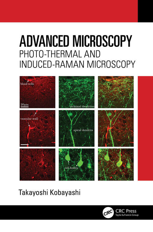 Book cover of Advanced Microscopy: Photo-Thermal and Induced-Raman Microscopy