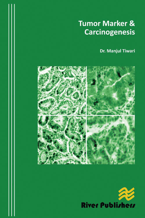 Book cover of Tumor Marker and Carcinogenesis