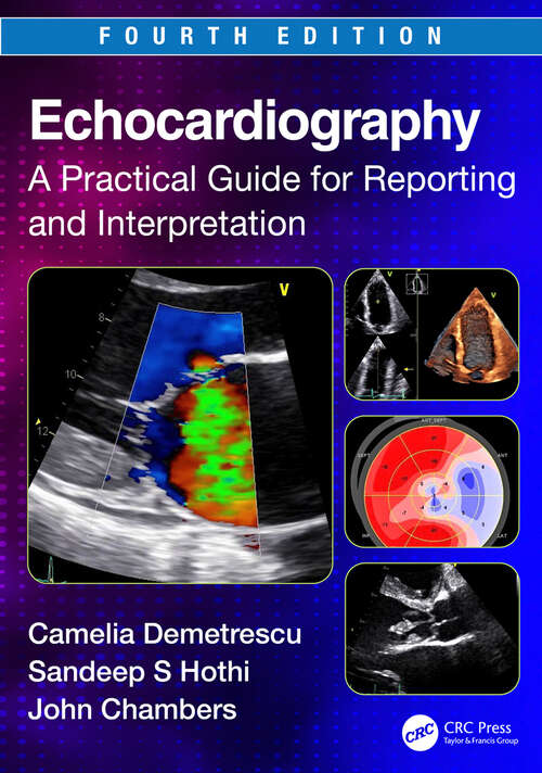 Book cover of Echocardiography: A Practical Guide for Reporting and Interpretation (4)