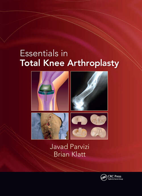 Book cover of Essentials in Total Knee Arthroplasty