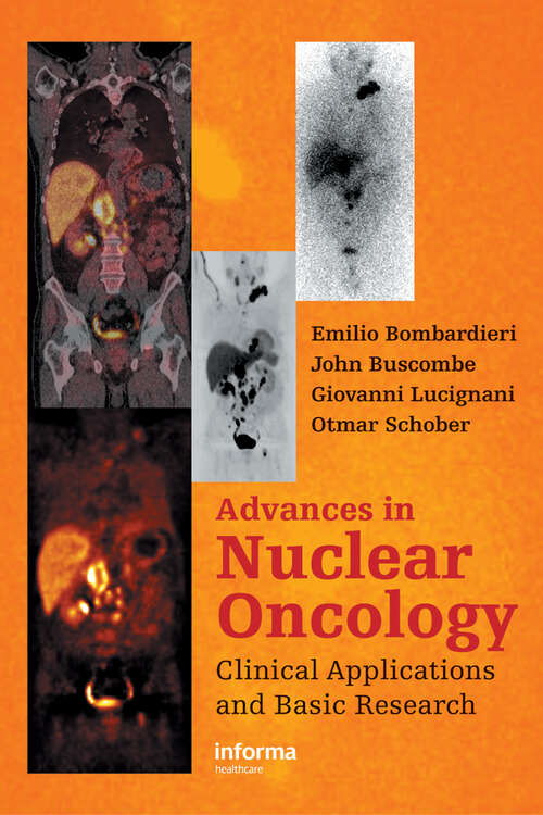 Book cover of Advances in Nuclear Oncology: Diagnosis and Therapy (1)