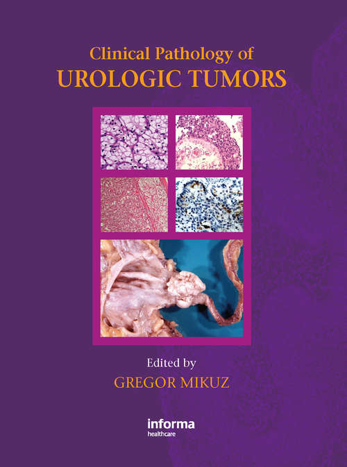 Book cover of Clinical Pathology of Urological Tumours