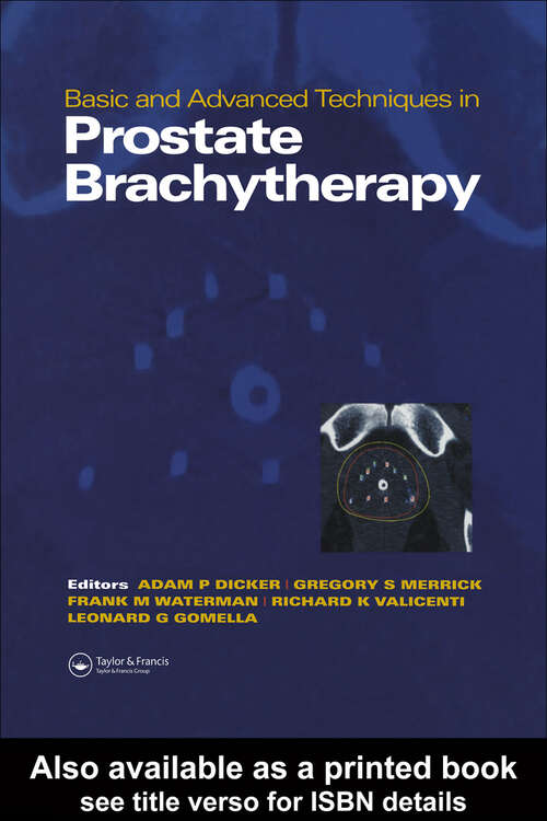 Book cover of Basic and Advanced Techniques in Prostate Brachytherapy (1)