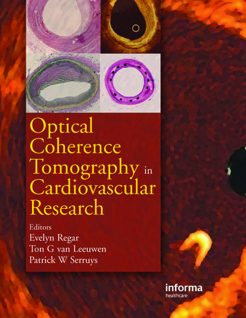 Book cover of Optical Coherence Tomography in Cardiovascular Research