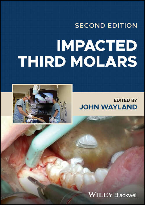 Book cover of Impacted Third Molars (2)