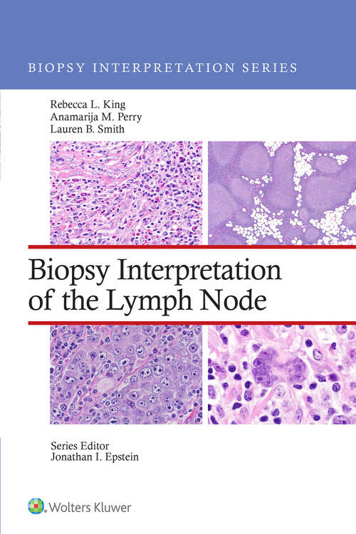 Book cover of Biopsy Interpretation of the Lymph Nodes (Biopsy Interpretation Series)