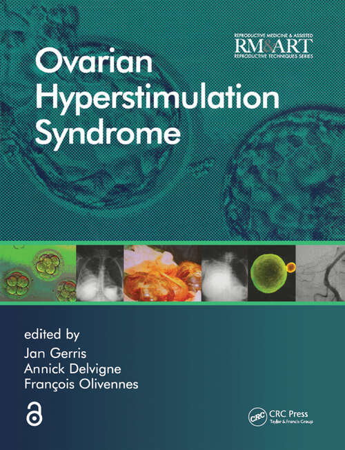 Book cover of Ovarian Hyperstimulation Syndrome (Reproductive Medicine and Assisted Reproductive Techniques Series)